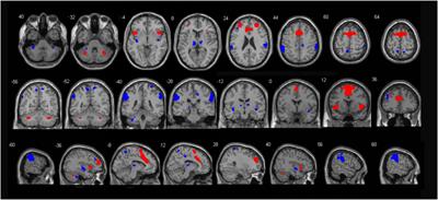 How Do You Feel Now? The Salience Network Functional Connectivity in End-Stage Renal Disease